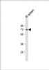 Western Blot at 1:1000 dilution + mouse spleen lysate Lysates/proteins at 20 ug per lane.