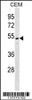 Western blot analysis in CEM cell line lysates (35ug/lane) .