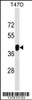 Western blot analysis in T47D cell line lysates (35ug/lane) .