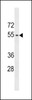 Western blot analysis in A2058 cell line lysates (35ug/lane) .