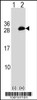 Western blot analysis of UBE2T using rabbit polyclonal UBE2T Antibody using 293 cell lysates (2 ug/lane) either nontransfected (Lane 1) or transiently transfected (Lane 2) with the UBE2T gene.