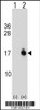 Western blot analysis of ACYP1 using rabbit polyclonal ACYP1 Antibody using 293 cell lysates (2 ug/lane) either nontransfected (Lane 1) or transiently transfected (Lane 2) with the ACYP1 gene.