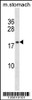 Western blot analysis in mouse stomach tissue lysates (35ug/lane) .