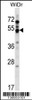 Western blot analysis in WiDr cell line lysates (35ug/lane) .