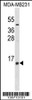 Western blot analysis in MDA-MB231 cell line lysates (35ug/lane) .