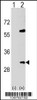 Western blot analysis of SNF8 using rabbit polyclonal SNF8 Antibody using 293 cell lysates (2 ug/lane) either nontransfected (Lane 1) or transiently transfected (Lane 2) with the SNF8 gene.