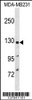 Western blot analysis in MDA-MB231 cell line lysates (35ug/lane) .