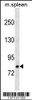 Western blot analysis in mouse spleen tissue lysates (35ug/lane) .