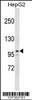 Western blot analysis in HepG2 cell line lysates (35ug/lane) .