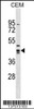 Western blot analysis in CEM cell line lysates (35ug/lane) .