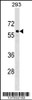 Western blot analysis in 293 cell line lysates (35ug/lane) .