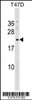 Western blot analysis in T47D cell line lysates (35ug/lane) .