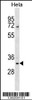 Western blot analysis in Hela cell line lysates (35ug/lane) .