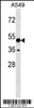 Western blot analysis in A549 cell line lysates (35ug/lane) .