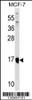 Western blot analysis in MCF-7 cell line lysates (35ug/lane) .