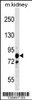 Western blot analysis in mouse kidney tissue lysates (35ug/lane) .