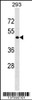 Western blot analysis in 293 cell line lysates (35ug/lane) .