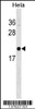 Western blot analysis in Hela cell line lysates (35ug/lane) .