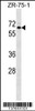 Western blot analysis in ZR-75-1 cell line lysates (35ug/lane) .