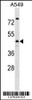 Western blot analysis in A549 cell line lysates (35ug/lane) .