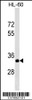 Western blot analysis in HL-60 cell line lysates (35ug/lane) .