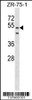 Western blot analysis in ZR-75-1 cell line lysates (35ug/lane) .