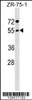 Western blot analysis in ZR-75-1 cell line lysates (35ug/lane) .