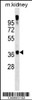 Western blot analysis in mouse kidney tissue lysates (35ug/lane) .