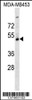 Western blot analysis in MDA-MB453 cell line lysates (35ug/lane) .