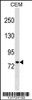 Western blot analysis in CEM cell line lysates (35ug/lane) .