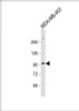 Western Blot at 1:1000 dilution + MDA-MB-453 whole cell lysate Lysates/proteins at 20 ug per lane.