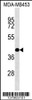 Western blot analysis in MDA-MB453 cell line lysates (35ug/lane) .