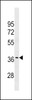 Western blot analysis in MDA-MB453 cell line lysates (35ug/lane) .