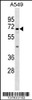 Western blot analysis in A549 cell line lysates (35ug/lane) .