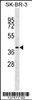 Western blot analysis in SK-BR-3 cell line lysates (35ug/lane) .