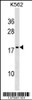 Western blot analysis in K562 cell line lysates (35ug/lane) .