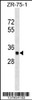 Western blot analysis in ZR-75-1 cell line lysates (35ug/lane) .