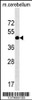 Western blot analysis in mouse cerebellum tissue lysates (35ug/lane) .