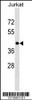 Western blot analysis in Jurkat cell line lysates (35ug/lane) .