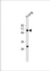 Western Blot at 1:1000 dilution + human lung lysate Lysates/proteins at 20 ug per lane.