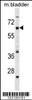 Western blot analysis in mouse bladder tissue lysates (35ug/lane) .