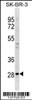 Western blot analysis in SK-BR-3 cell line lysates (35ug/lane) .