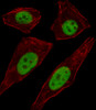 Fluorescent image of A549 cell stained with TFAP2D Antibody .A549 cells were fixed with 4% PFA (20 min) , permeabilized with Triton X-100 (0.1%, 10 min) , then incubated with TFAP2D primary antibody (1:25) . For secondary antibody, Alexa Fluor 488 conjugated donkey anti-rabbit antibody (green) was used (1:400) .Cytoplasmic actin was counterstained with Alexa Fluor 555 (red) conjugated Phalloidin (7units/ml) .TFAP2D immunoreactivity is localized to Nucleus significantly.