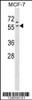 Western blot analysis in MCF-7 cell line lysates (35ug/lane) .