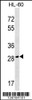 Western blot analysis in HL-60 cell line lysates (35ug/lane) .