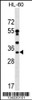 Western blot analysis in HL-60 cell line lysates (35ug/lane) .