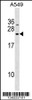 Western blot analysis in A549 cell line lysates (35ug/lane) .