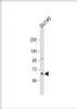 Western Blot at 1:1000 dilution + DU145 whole cell lysate Lysates/proteins at 20 ug per lane.