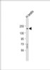 Western Blot at 1:1000 dilution + human testis lysate Lysates/proteins at 20 ug per lane.