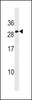 Western blot analysis in CEM cell line lysates (35ug/lane) .This demonstrates the detected the Erythropoietin protein (arrow) .